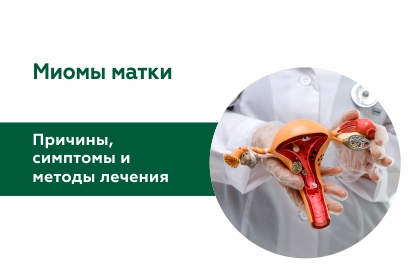 Миомы: причины, симптомы, методы лечения