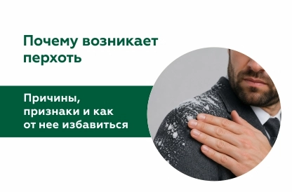 Почему возникает перхоть: причины, признаки и как от нее избавиться