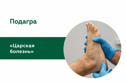 Подагра - «царская болезнь»